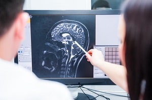 Larimer County personal injury attorney TBI